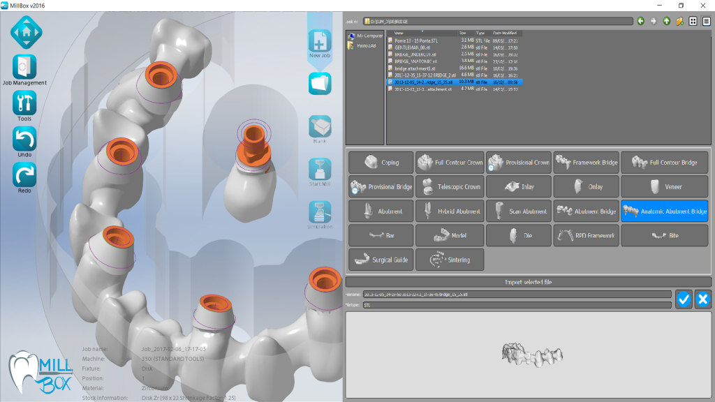 картинка MILLBOX - программа моделирования для CAD-систем от магазина Udentis.ru