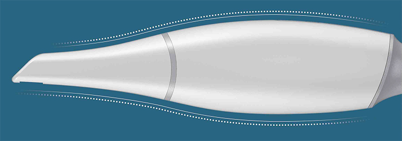 Fussen S6000 – Стоматологический интраоральный 3D-сканер Fussen S6000 – Стоматологический интраоральный 3D-сканер