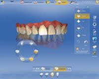 Sirona CEREC AC — цифровая система с камерой CEREC OMNICAM