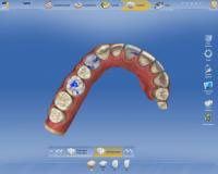 Sirona CEREC AC — цифровая система с камерой CEREC OMNICAM