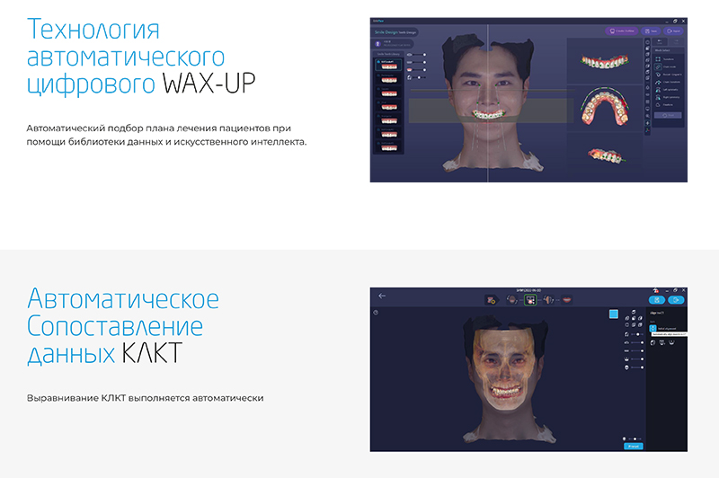 Ray RAYFace – 3D сканер лица