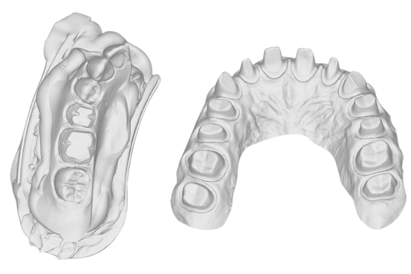 Ray RAYDENT Microscan – стоматологический настольный 3D-сканер с технологией Micro-CT