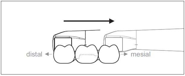 Sirona CEREC AC — цифровая система с камерой CEREC OMNICAM