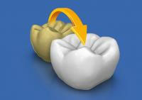 Sirona CEREC AC — цифровая система с камерой CEREC OMNICAM