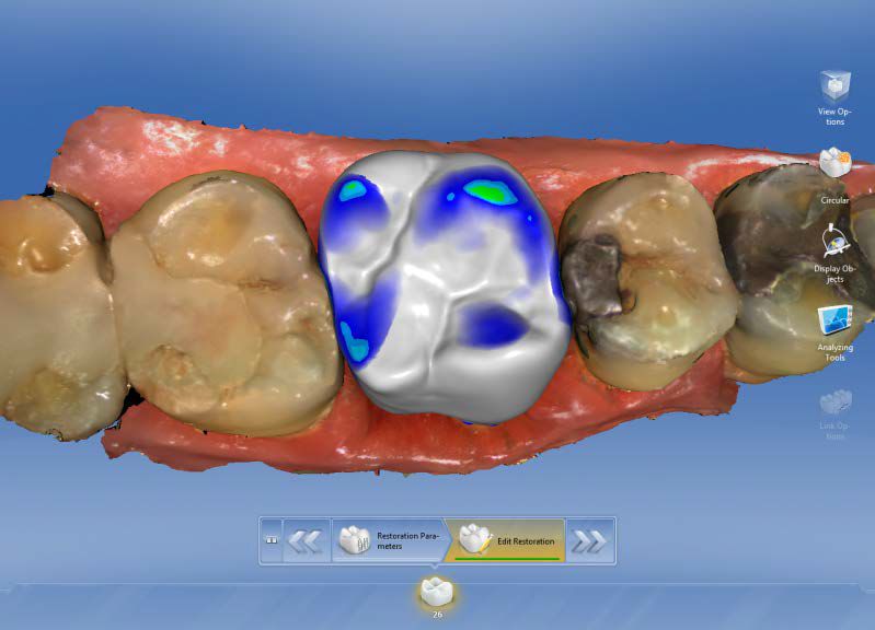 Sirona CEREC AC — цифровая система с камерой CEREC OMNICAM
