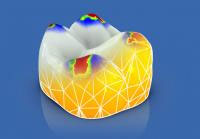 Sirona CEREC AC — цифровая система с камерой CEREC OMNICAM