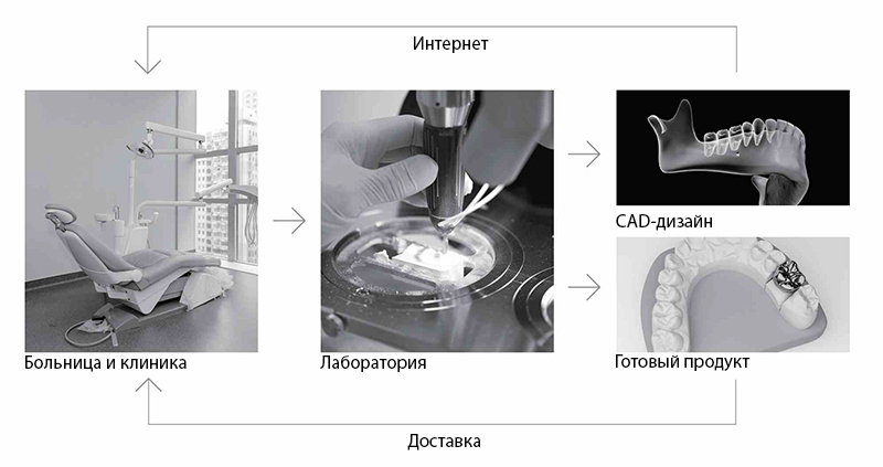 Fussen S6000 – Стоматологический интраоральный 3D-сканер Fussen S6000 – Стоматологический интраоральный 3D-сканер