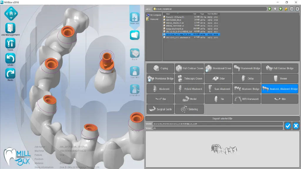 картинка MILLBOX - программа моделирования для CAD-систем от магазина Udentis.ru