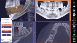 Exocad DICOM viewer - средство просмотра DICOM файлов
