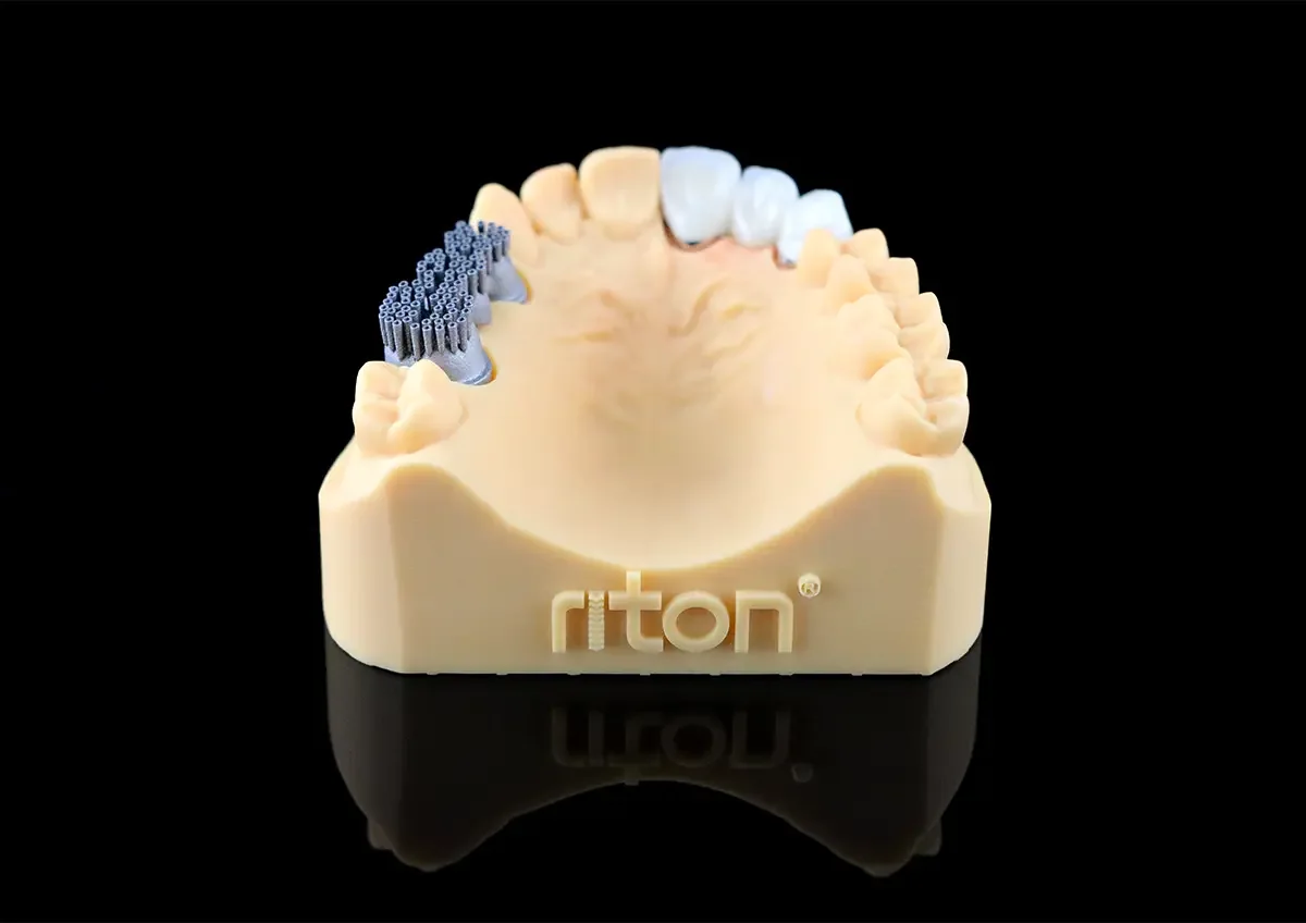Коронка из кобальт-хрома на модели, печать Riton M-150 SE