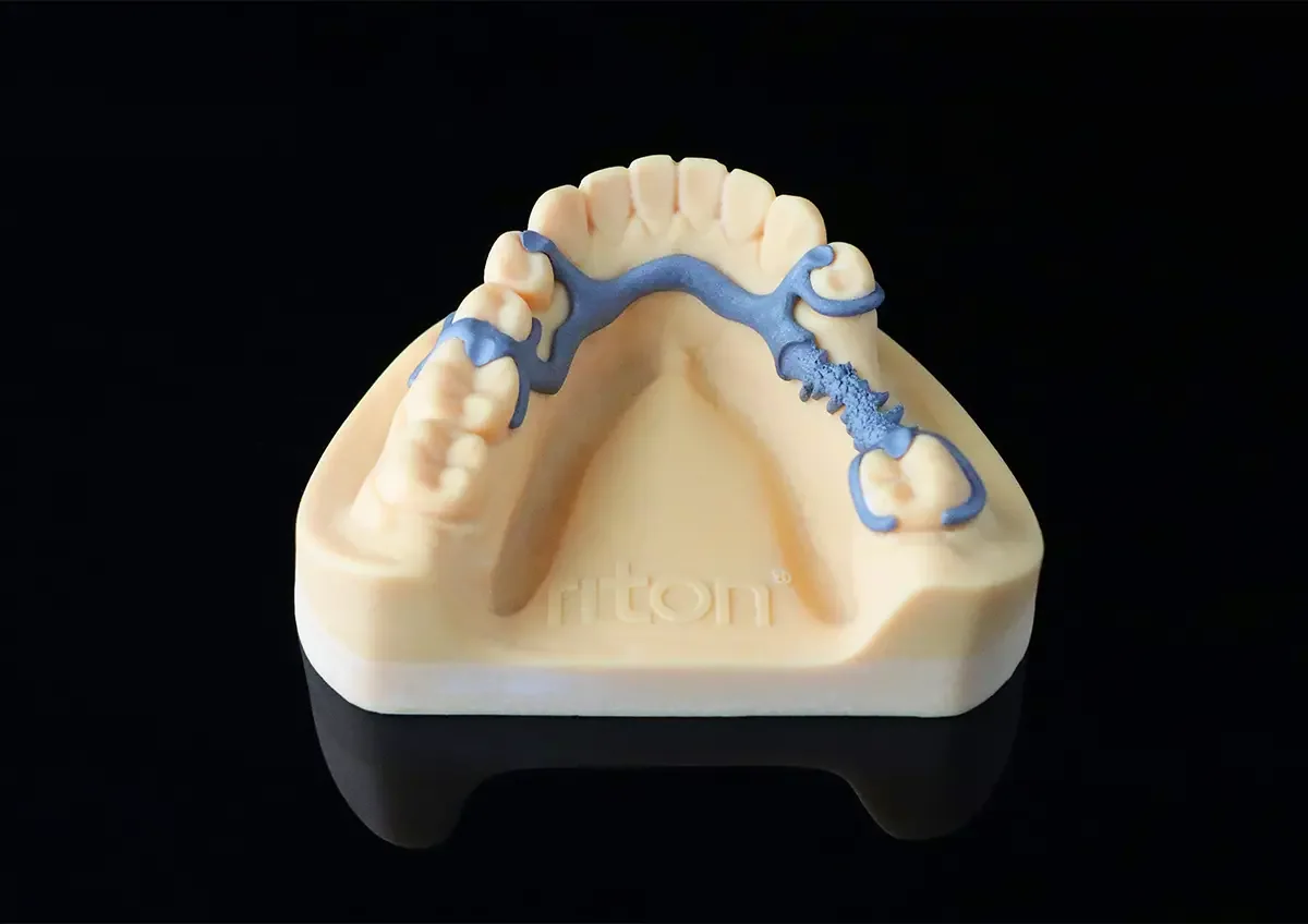 Титановый каркас на модели, напечатанный на SLM 3D-принтере Riton M-150D